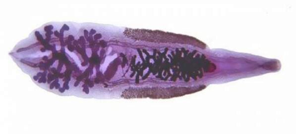 Lovitură siberiană