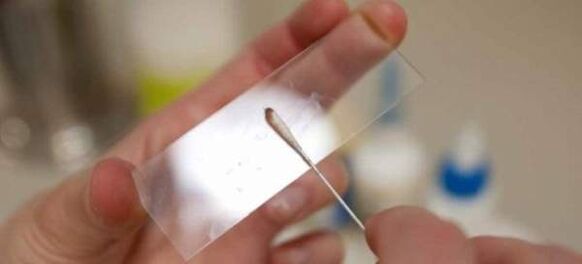 Răzuire pentru ouă de viermi